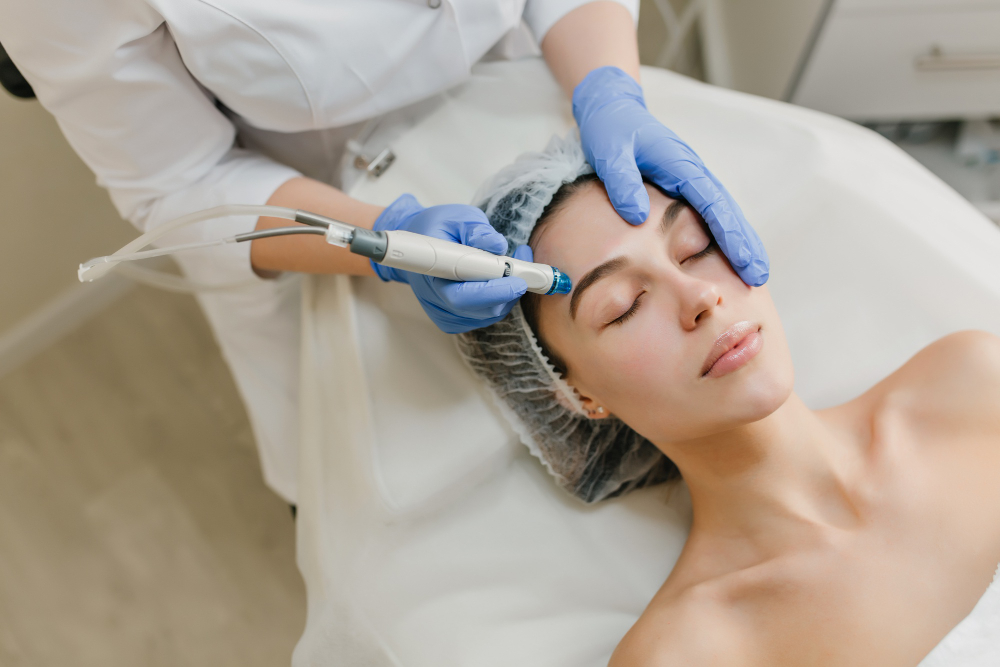 Professional microneedling treatment at Angel Skin Lab in Cheadle