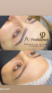 “Sterile single-use microblading equipment at Angel Skin Lab, Cheadle, Stockport”