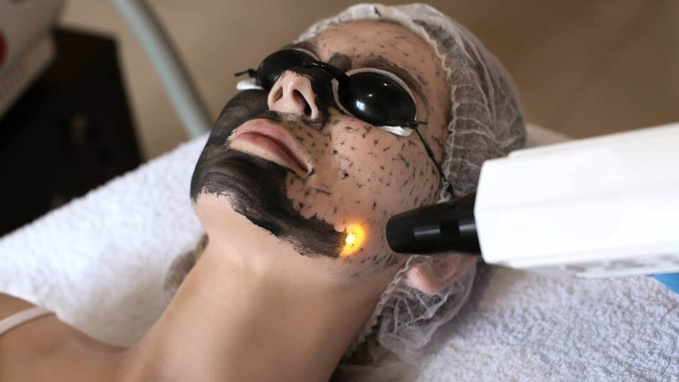 Professional carbon laser facial appointment at Angel Skin Lab in Cheadle