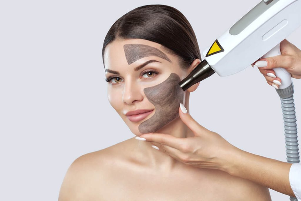 laser carbon peel Cheadle