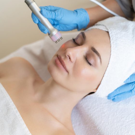 laser skin rejunivation